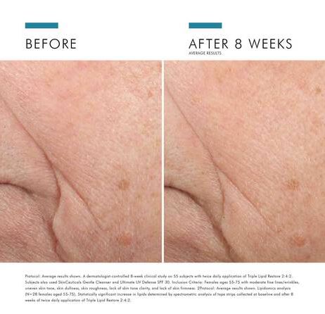 Advanced Anti-Aging SkinCeuticals Triple Lipid Restore 2:4:2