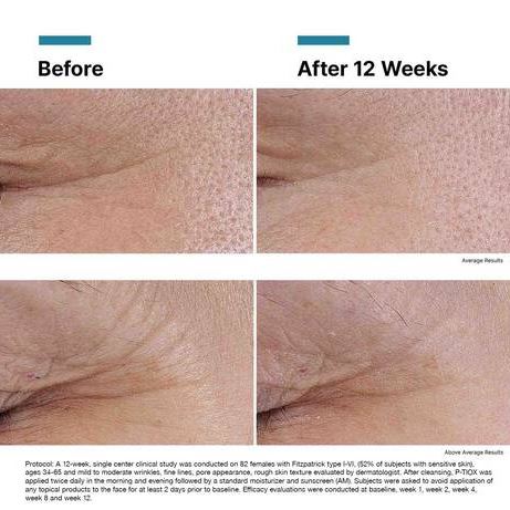 SkinCeuticals P-TIOX Anti-Wrinkle Peptide Serum (1 fl. oz.)